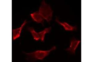 Image no. 1 for anti-Solute Carrier Family 5 (Iodide Transporter), Member 6 (SLC5A6) (C-Term) antibody (ABIN6258560)