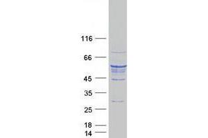 Image no. 1 for Tubulin, beta 5 (TUBB5) protein (Myc-DYKDDDDK Tag) (ABIN2734583)