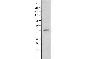 Image no. 1 for anti-Protein Kinase, AMP-Activated, gamma 1 Non-Catalytic Subunit (PRKAG1) (C-Term) antibody (ABIN6259160)
