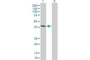 PECI/ECI2 antibody  (AA 1-364)