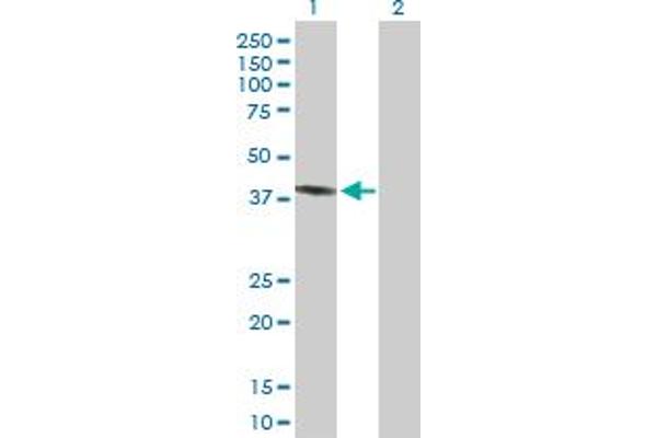 PECI/ECI2 anticorps  (AA 1-364)