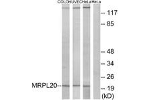 anti-Mitochondrial Ribosomal Protein L20 (MRPL20) (AA 100-149) antibody
