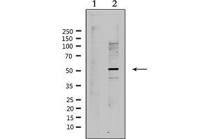 Image no. 3 for anti-DNA Repair Protein RAD51 Homolog 3 (RAD51C) antibody (ABIN6259171)