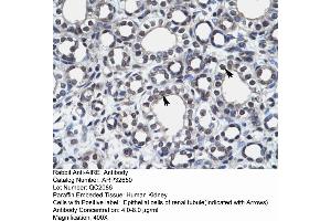Image no. 3 for anti-Autoimmune Regulator (AIRE) (N-Term) antibody (ABIN2779777)