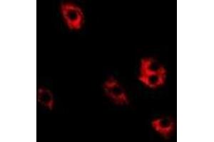 Image no. 1 for anti-Signal Recognition Particle 19kDa (SRP19) antibody (ABIN2967063)