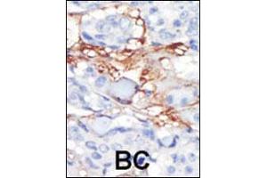 Image no. 3 for anti-Platelet-Derived Growth Factor Receptor-Like (PDGFRL) (AA 328-357), (C-Term) antibody (ABIN392037)