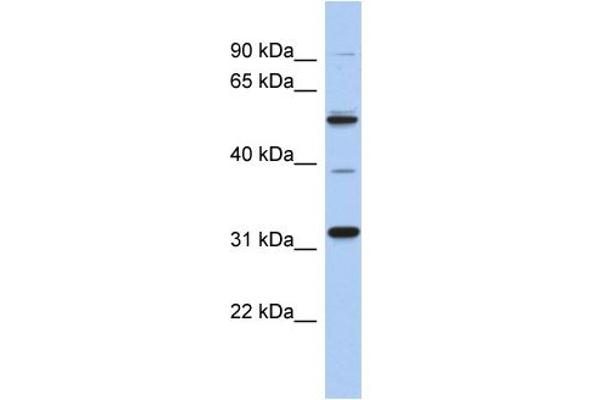 anti-TBC1 Domain Family, Member 26 (TBC1D26) (Middle Region) antibody