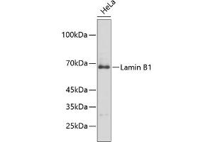 Western blot analysis of extracts of HeLa cells, using Lamin B1 antibody (ABIN1513160, ABIN3023296 and ABIN3023297).