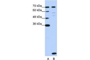 Image no. 1 for anti-LSM2 Homolog, U6 Small Nuclear RNA Associated (LSM2) (Middle Region) antibody (ABIN2776544)