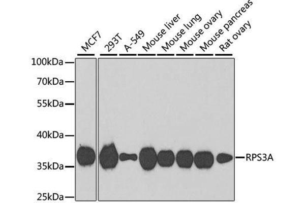 anti-Ribosomal Protein S3A (RPS3A) antibody
