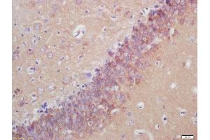 Formalin-fixed and paraffin embedded rat brain labeled with Anti-SPRN Polyclonal Antibody, Unconjugated  at 1:200 followed by conjugation to the secondary antibody and DAB staining