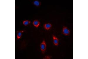 Image no. 1 for anti-Bone Marrow Stromal Cell Antigen 1 (BST1) (Center) antibody (ABIN2705747)