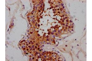 IHC image of ABIN7168374 diluted at 1:300 and staining in paraffin-embedded human testis tissue performed on a Leica BondTM system.