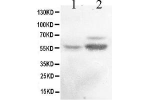 Image no. 1 for anti-Aldehyde Dehydrogenase 1 Family, Member A2 (ALDH1A2) (AA 1-110) antibody (ABIN4886449)