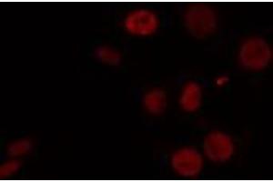 Image no. 2 for anti-CUGBP, Elav-Like Family Member 1 (CELF1) (N-Term) antibody (ABIN6258447)