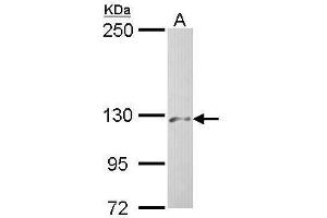 Image no. 1 for anti-Phosphorylase Kinase, alpha 2 (PHKA2) (C-Term) antibody (ABIN2856594)