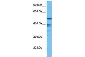 Image no. 2 for anti-Growth Factor Independent 1 (GFI1) (N-Term) antibody (ABIN2777468)