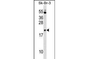 NKIRAS1 Antibody (Center) (ABIN1538446 and ABIN2849067) western blot analysis in SK-BR-3 cell line lysates (35 μg/lane).