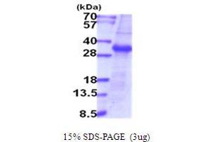 Image no. 1 for Transmembrane Protease, serine 15 (TMPRSS15) (AA 785-10199) protein (ABIN5854071)