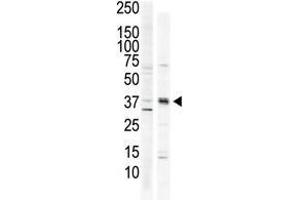 Image no. 2 for anti-Calcium/calmodulin-Dependent Protein Kinase I (CAMK1) (C-Term) antibody (ABIN359399)