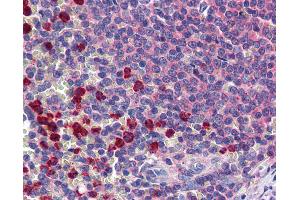 CLEC2D antibody  (AA 1-155)