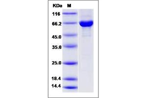 Image no. 1 for rho GTPase Activating Protein 2 (ARHGAP2) (AA 2-459) protein (GST tag,His tag) (ABIN2006368)