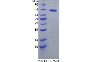 Image no. 1 for Brevican (BCAN) (AA 23-353) protein (His tag) (ABIN6238304)