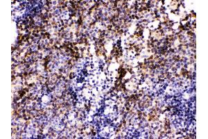 Image no. 1 for anti-Paired Box Gene 2a (PAX2A) (AA 248-282), (C-Term) antibody (ABIN3043591)