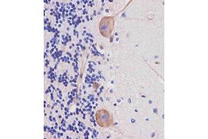 Image no. 7 for anti-Nestin (NES) (AA 1389-1416) antibody (ABIN388764)