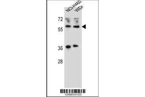 Image no. 1 for anti-Wilms Tumor 1 Interacting Protein (WTIP) (AA 243-271) antibody (ABIN655782)