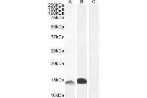 Image no. 5 for anti-S100 Calcium Binding Protein A9 (S100A9) (Internal Region) antibody (ABIN335161)