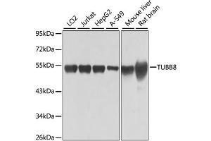 Image no. 3 for anti-Tubulin, beta 8 (TUBB8) antibody (ABIN6567594)