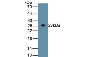 Image no. 4 for Apolipoprotein B (APOB) ELISA Kit (ABIN6730915)