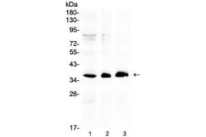 Image no. 1 for anti-Aldo-Keto Reductase Family 1, Member B10 (Aldose Reductase) (AKR1B10) (AA 285-316) antibody (ABIN5647462)