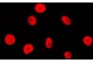 Image no. 1 for anti-Mismatch Repair Protein 2 (MSH2) antibody (ABIN2801279)