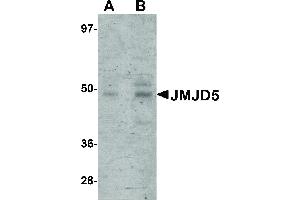 Image no. 1 for anti-Jumonji Domain Containing 5 (JMJD5) (C-Term) antibody (ABIN6656235)