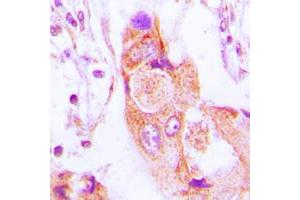 Image no. 3 for anti-Absent in Melanoma 2 (AIM2) (Center) antibody (ABIN2705417)