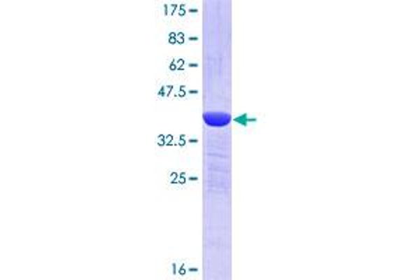 TFG Protein (AA 1-110) (GST tag)