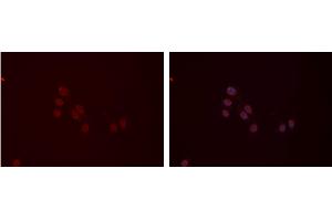 Image no. 3 for anti-Myosin Regulatory Light Chain 2, Smooth Muscle Isoform (MYL9) antibody (ABIN6266252)