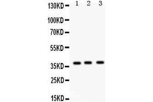 Image no. 3 for anti-Surfactant Protein D (SFTPD) (AA 292-321), (C-Term) antibody (ABIN3043335)