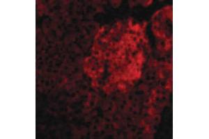 Image no. 2 for anti-Interleukin 23 (IL23) (N-Term) antibody (ABIN6655812)