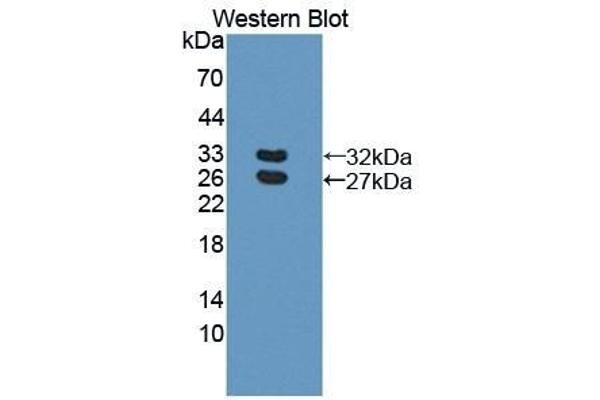 BCAM Antikörper  (AA 32-257)