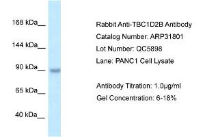 Image no. 1 for anti-TBC1 Domain Family, Member 2B (TBC1D2B) (C-Term) antibody (ABIN2777437)