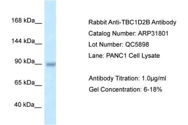 TBC1D2B 抗体  (C-Term)