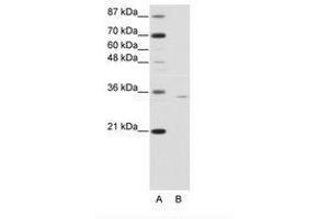 Image no. 1 for anti-Orthopedia Homeobox (OTP) (C-Term) antibody (ABIN6736160)