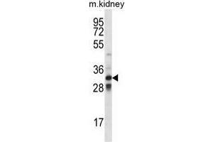 Image no. 1 for anti-T-Cell Leukemia Homeobox 1 (TLX1) (AA 162-191), (Middle Region) antibody (ABIN955235)