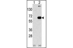 Image no. 2 for anti-Sequestosome 1 (SQSTM1) (AA 324-353), (C-Term) antibody (ABIN1449619)