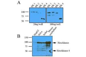 Image no. 3 for anti-Hexokinase 1 (HK1) (AA 1-917), (N-Term) antibody (ABIN317095)