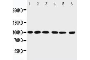 Image no. 1 for anti-Protein Inhibitor of Activated STAT, 1 (PIAS1) (AA 636-651) antibody (ABIN3032369)