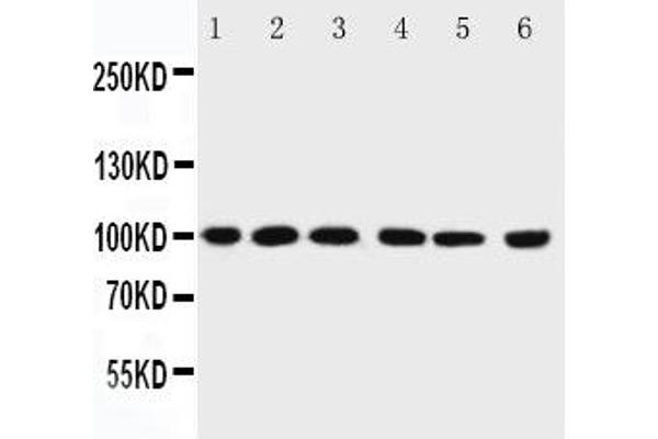 anti-Protein Inhibitor of Activated STAT, 1 (PIAS1) (AA 636-651) antibody